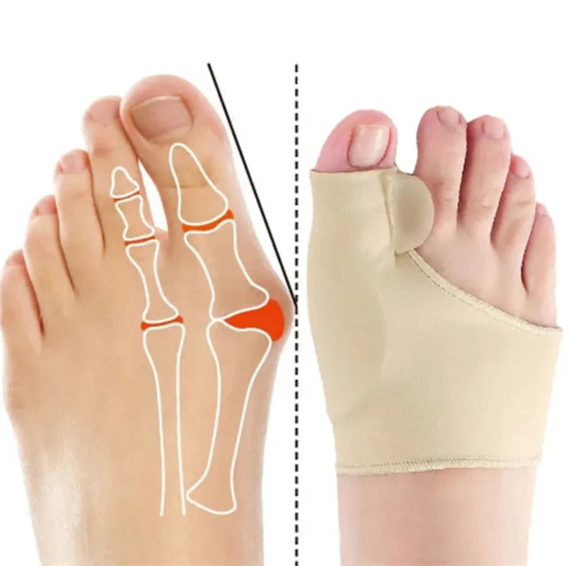 Calcetines correctores para juanetes OrthoPies™