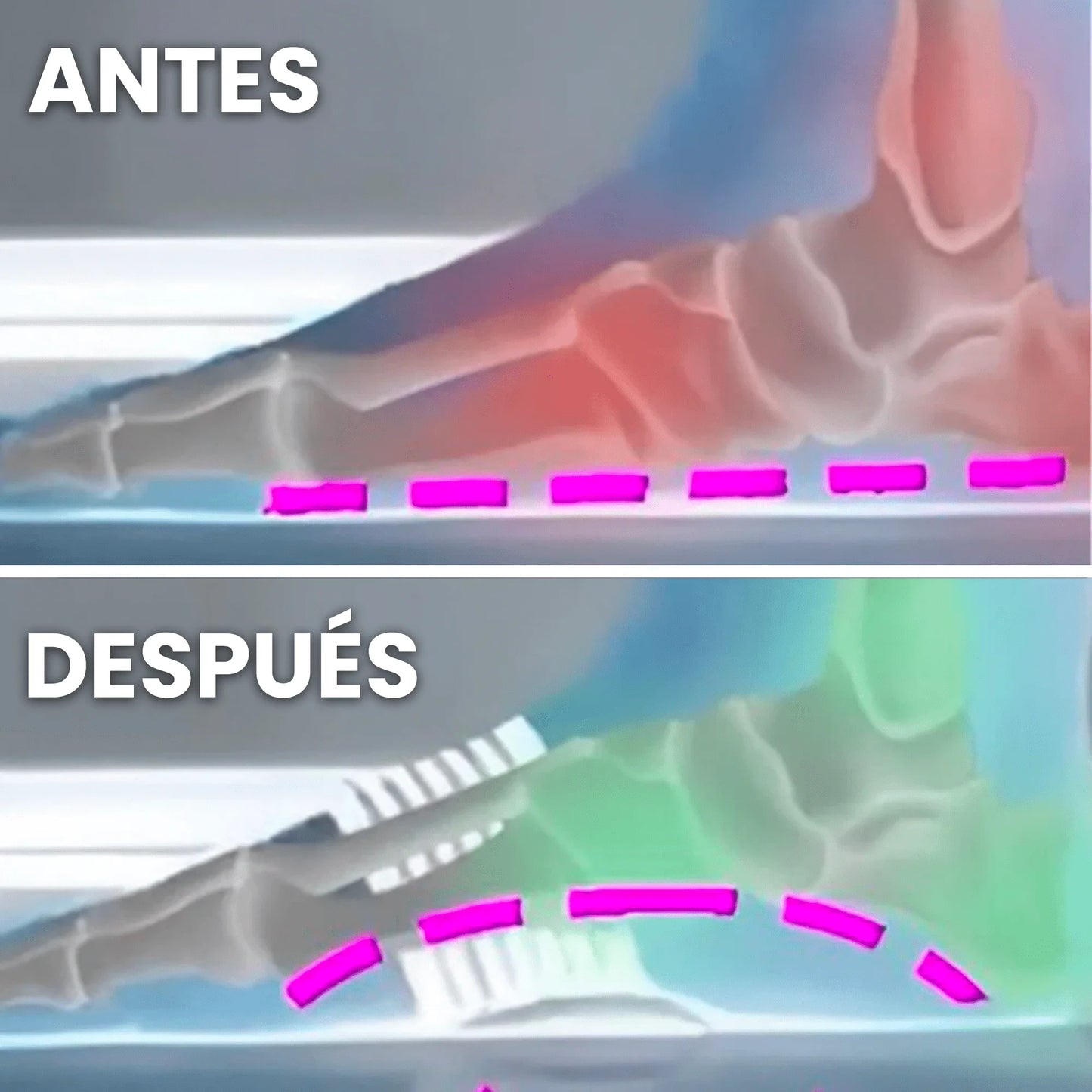 Soporte para el arco del pie OrthoPies™ a un precio especial