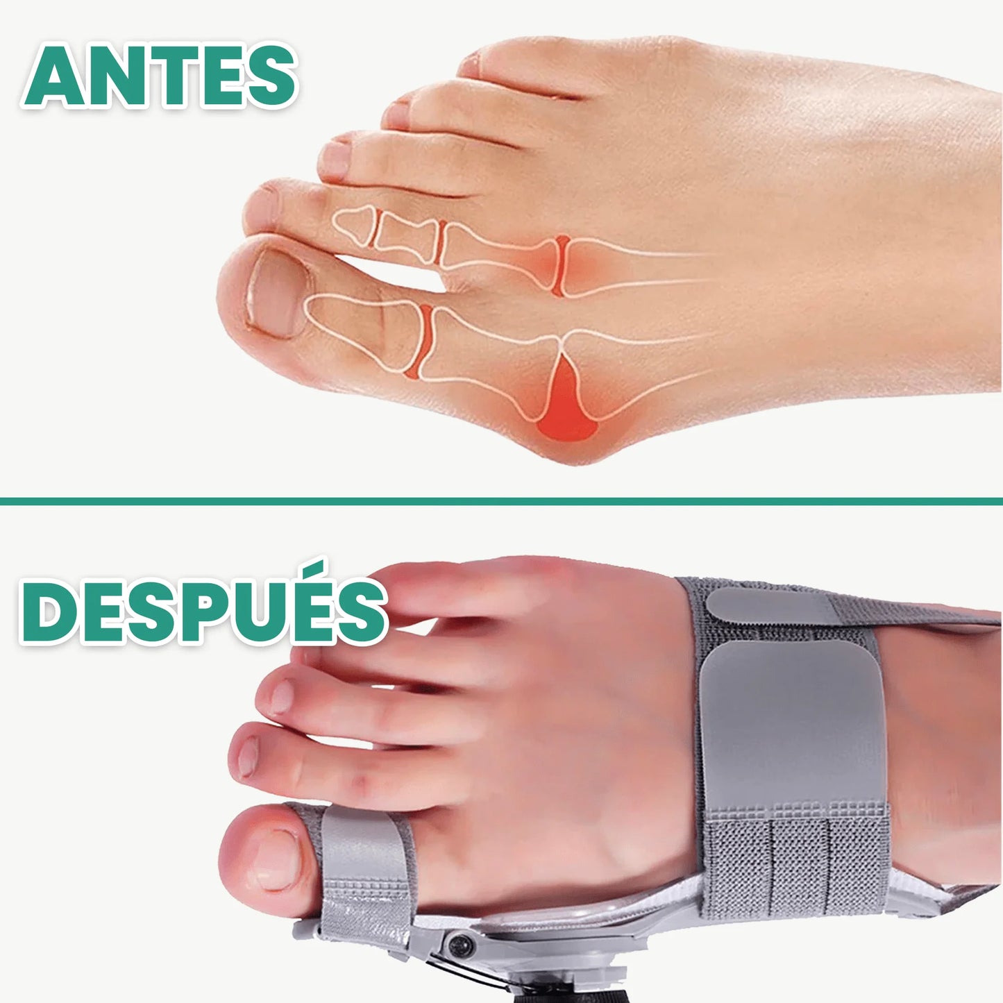 Corrector de Juanetes OrthoPies™ a un precio especial
