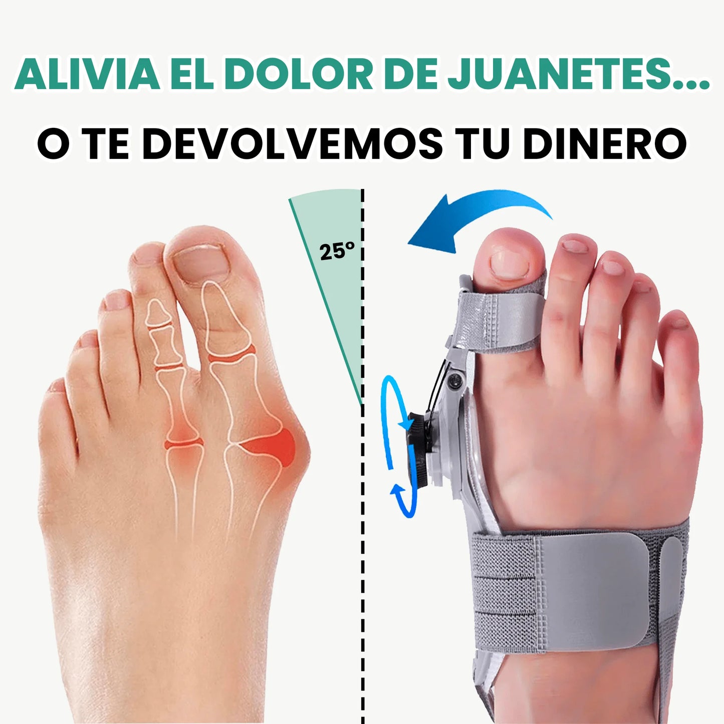 Corrector de Juanetes OrthoPies™ a un precio especial