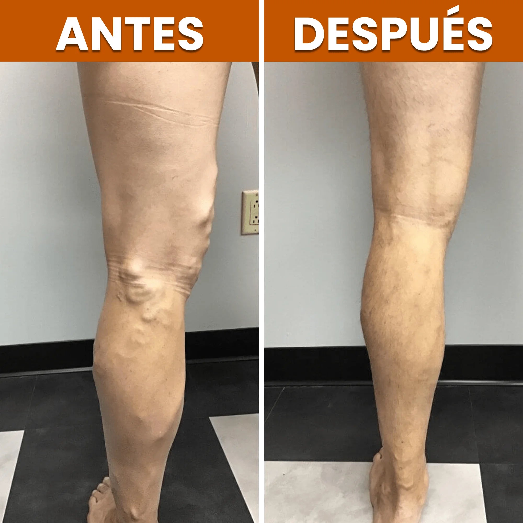 Almohadilla de Compresión para Pies OrthoPies™